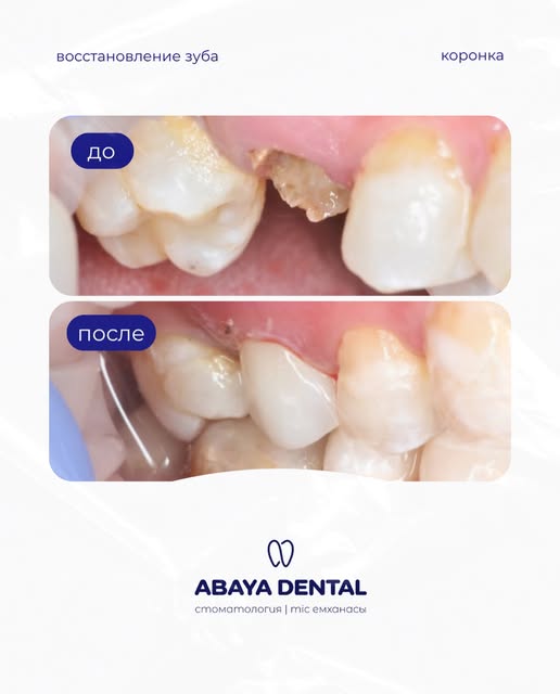 Abaya Dental